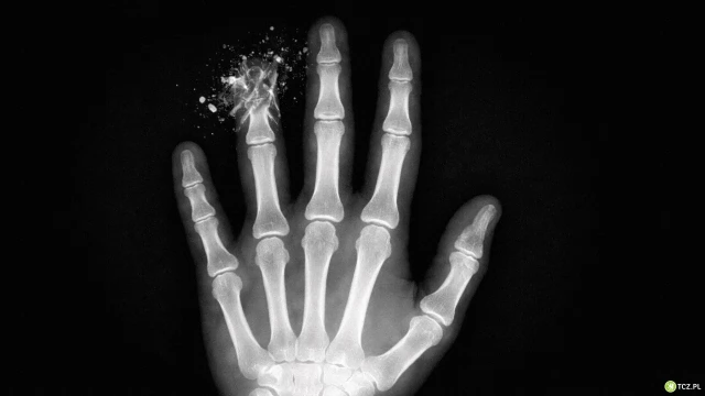 Tczew - Chcesz wejść w nowy rok z kompletem palców? Pamiętaj o tych zasadach