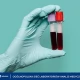 Tczew - Morfologia krwi - jak pomaga w diagnostyce anemii?