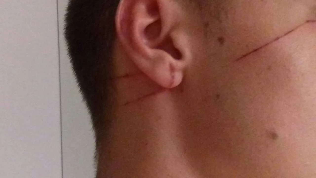 "Bolesne rany na szyi i dużo strachu". Ktoś "dla zabawy" rozpiął żyłkę na chodniku i drodze rowerowej?