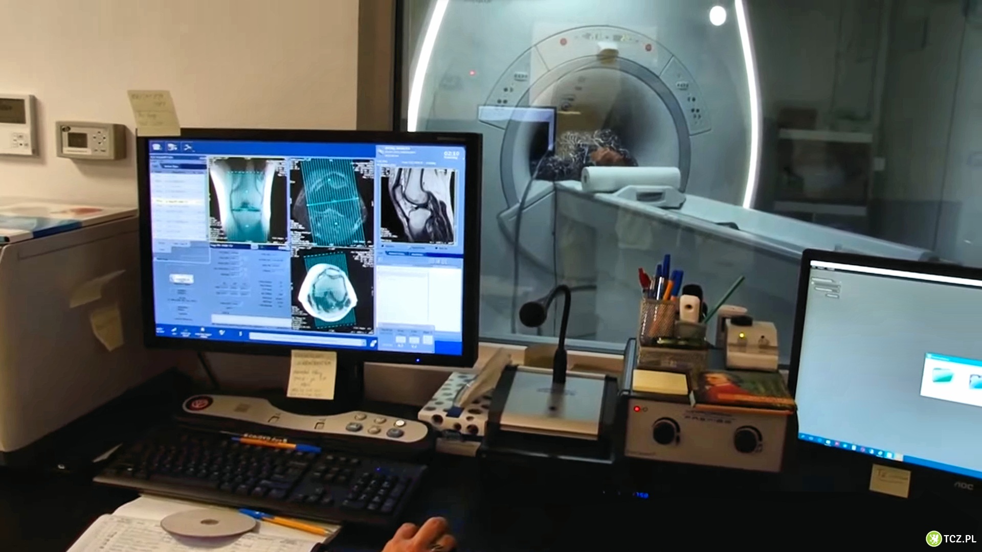 Badania obrazowe i endoskopia - NFZ oszczędza, pacjenci poczekają - Aktualności